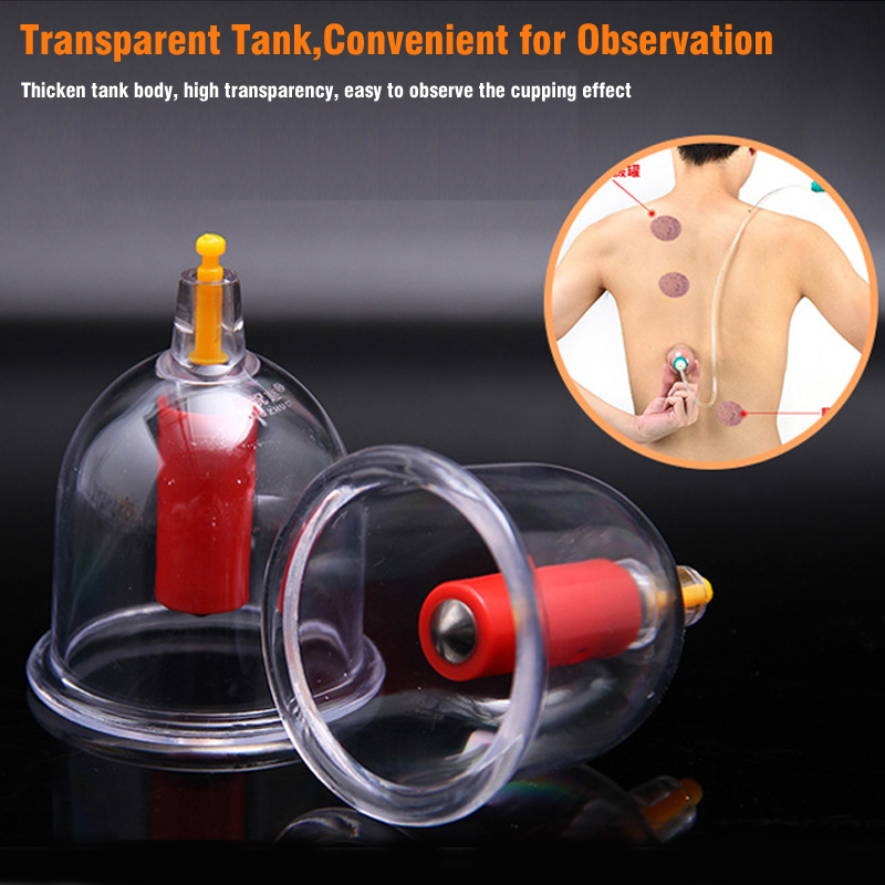 ชุดถ้วยนวดสุญญากาศแบบจีน 32 ชิ - Cupping Therapy Set บทวิจารณ์และราคา