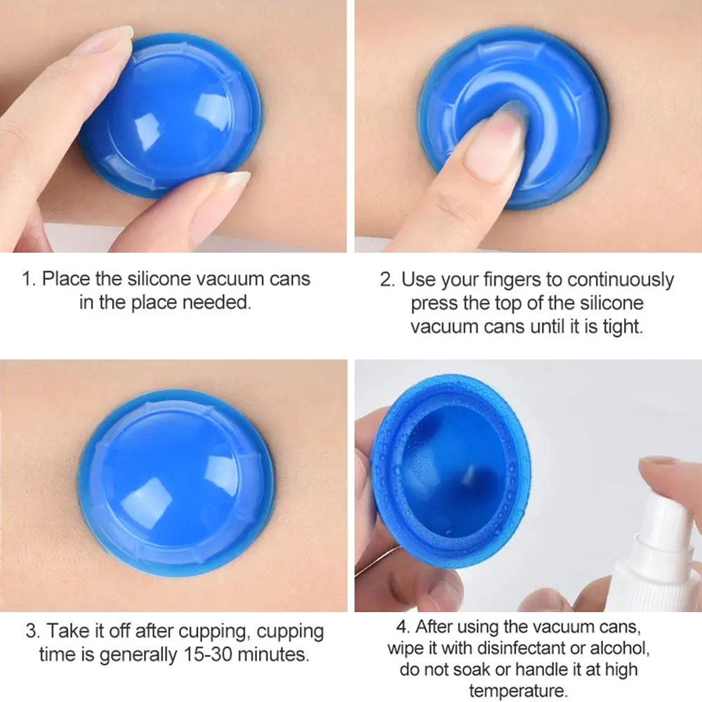 12PCS ซิลิโคนดูดสูญญากาศกระป๋อ - Cupping Therapy Set บทวิจารณ์และราคา