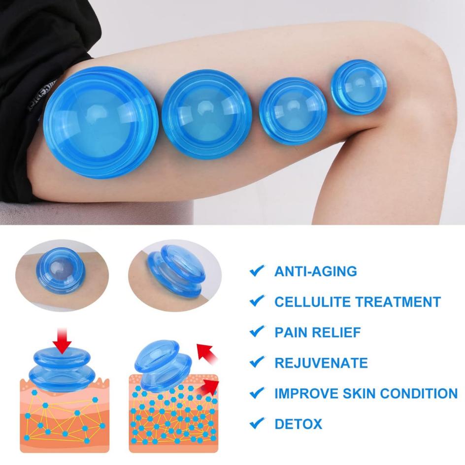 ชุดถ้วยซิลิโคนสำหรับนวด 3 ชิ้น - Cupping Therapy Set บทวิจารณ์และราคา